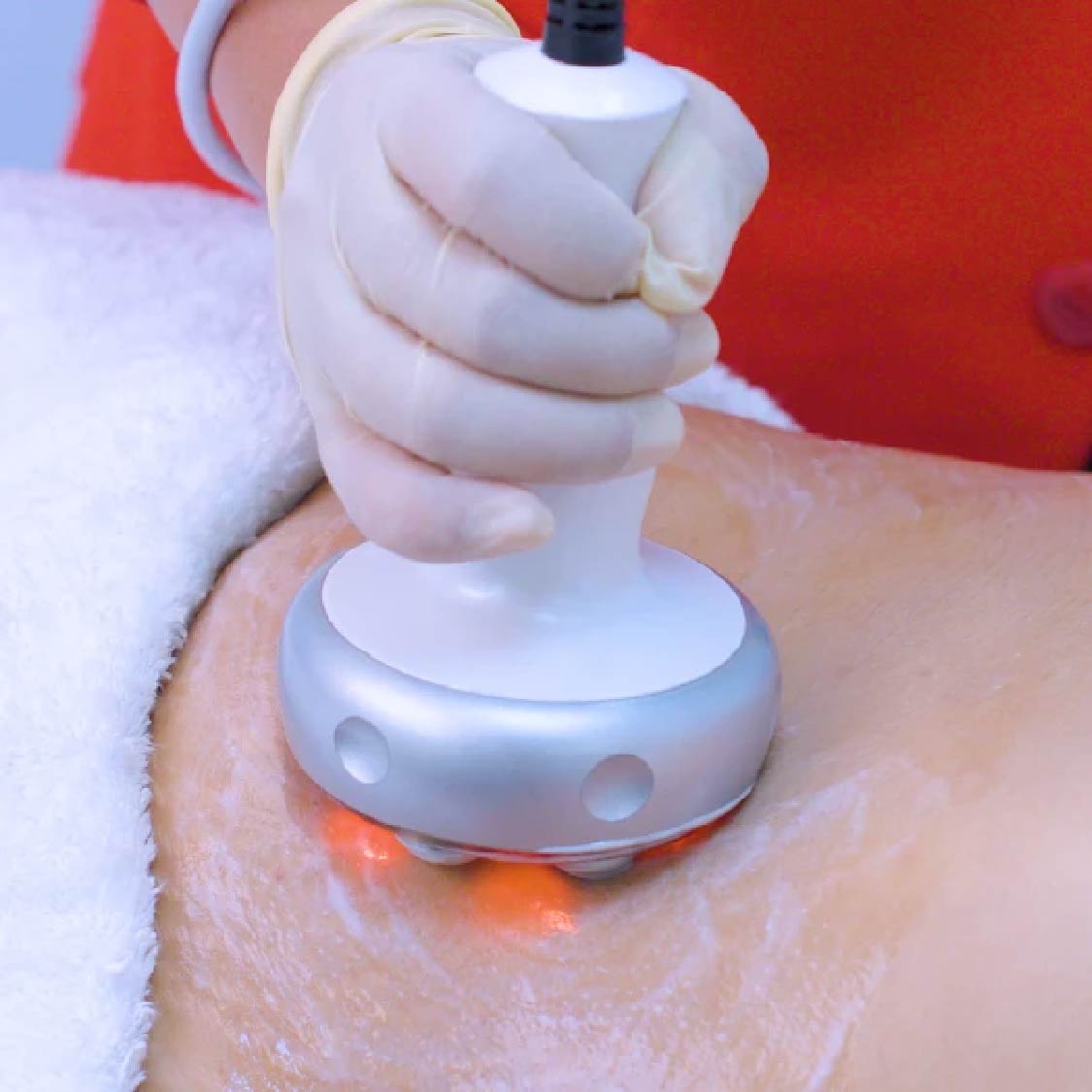 RF Body Shaping Treatment