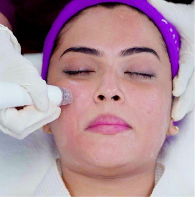 DermaBright Facial Treatment
