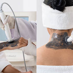 Charcoal Glow Hand & Neck Premium Bio-Hydra Treatment