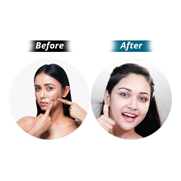 BioCare Handmade Niacinamide Brightening Beauty Bar